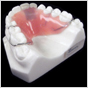 Partial denture on model at Esthetic Designs dental lab